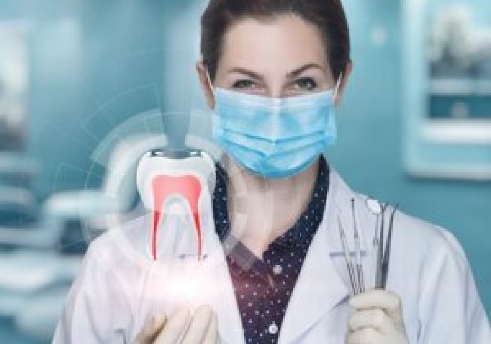 Root-Canal